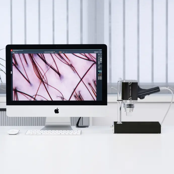 Tricoscopia con Tricholab